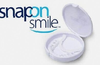 Snap-on Smile - Qu'est-ce que c'est